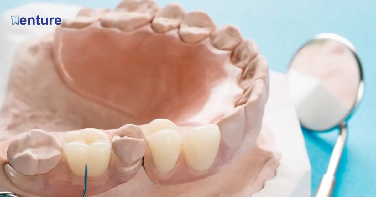 How Often Should Dentures Be Replaced?
