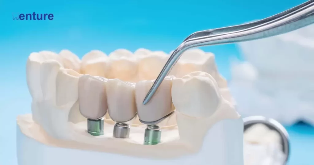 Best Dentures for Lower Teeth