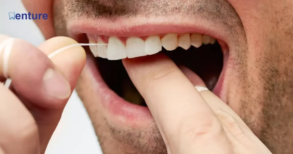 Bite check and choosing your new teeth