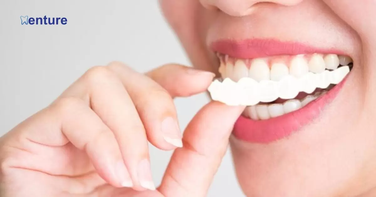 Can You Wear Veneers Over Dentures?
