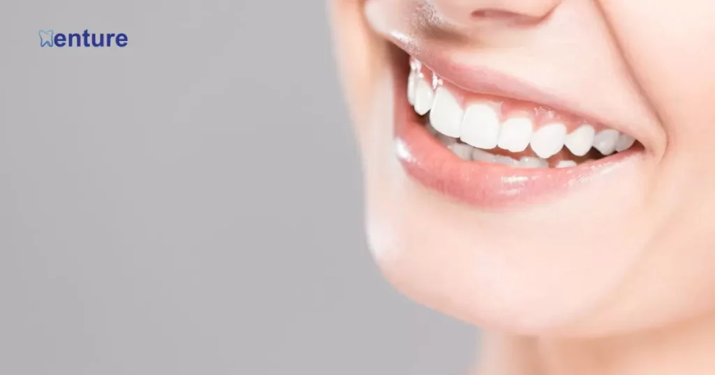 How Dental Veneers Can Beautify Your Teeth