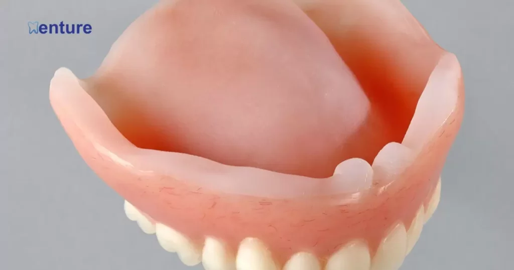 How long does a soft liner last in dentures?