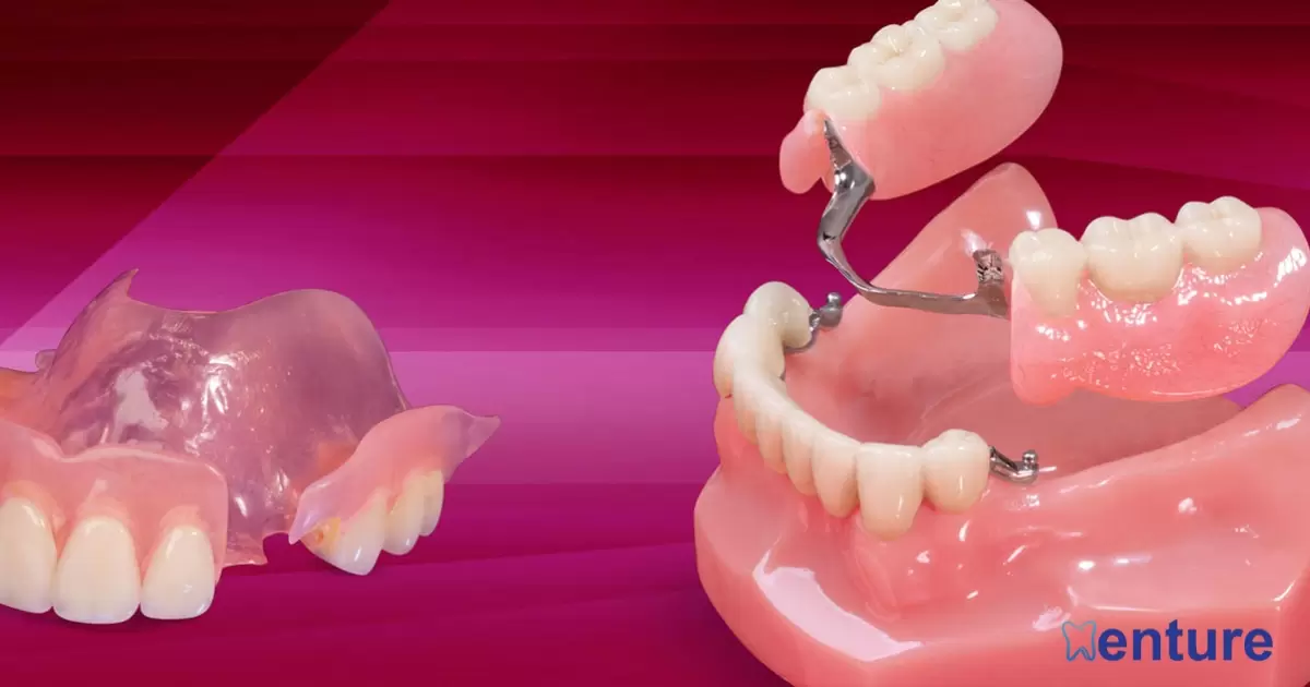 How Long Does It Take To Get Partial Dentures?