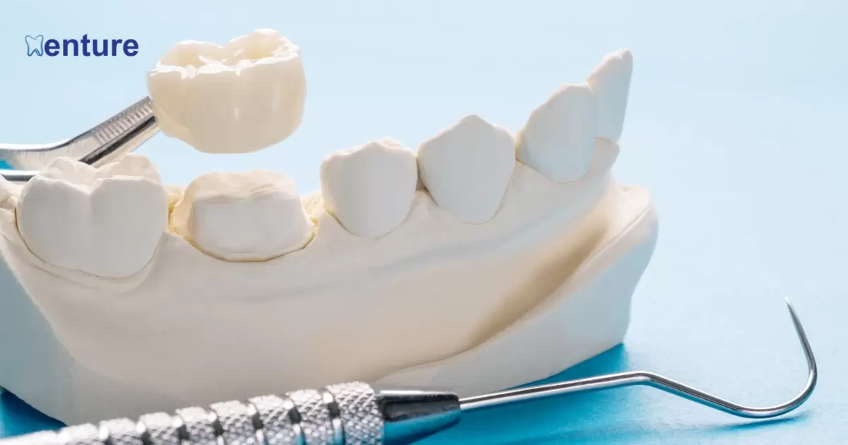 How Long Does It Take To Make Dentures?