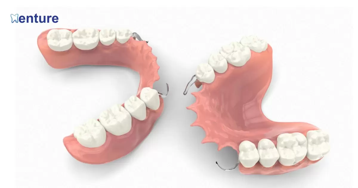How Many Teeth Do You Need For A Partial Denture?