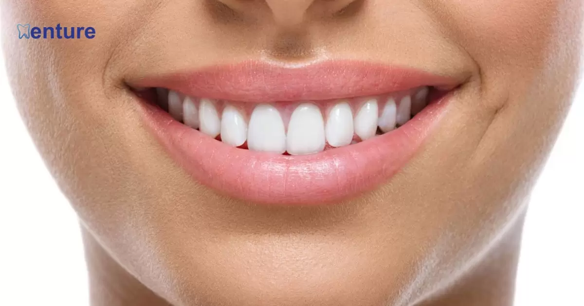 How To Get Lip Support From Dentures?