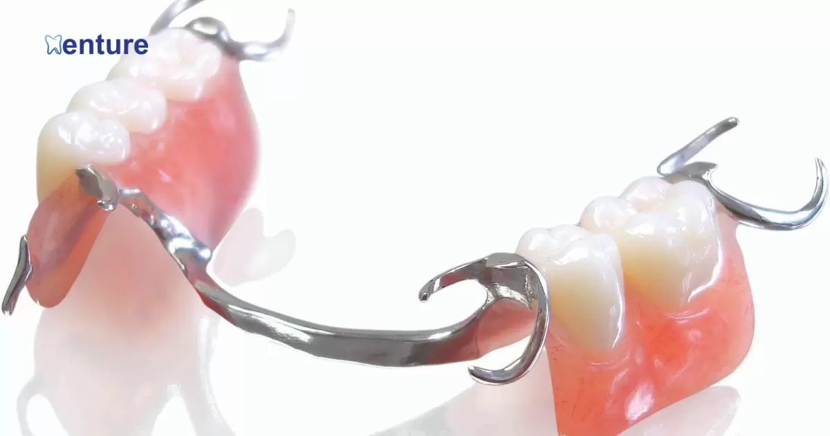 How To Remove Partial Dentures For The First Time?
