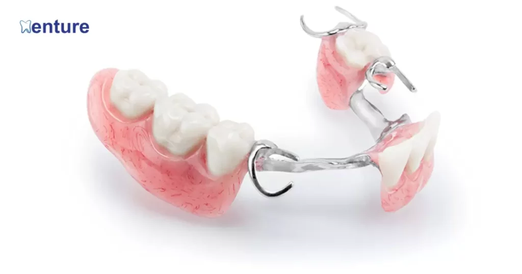 Metal Clasp Problems on Partial Dentures