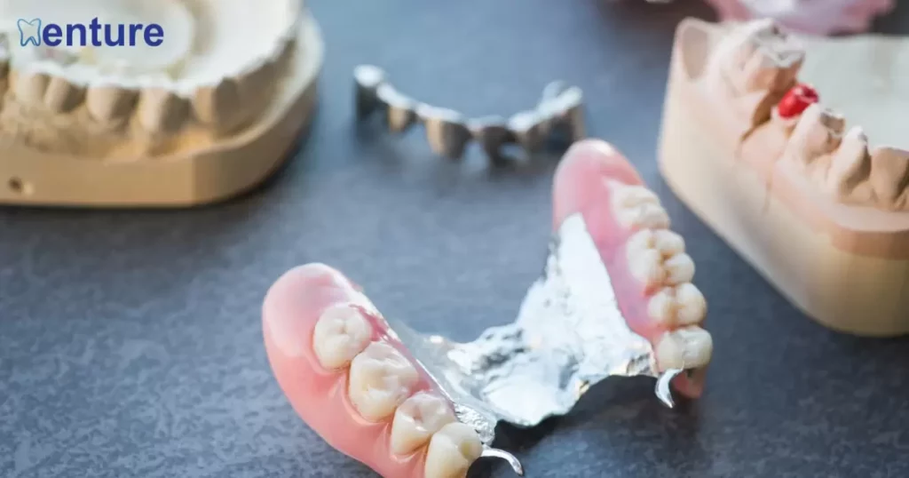 What categories of Partial Dentures exist?