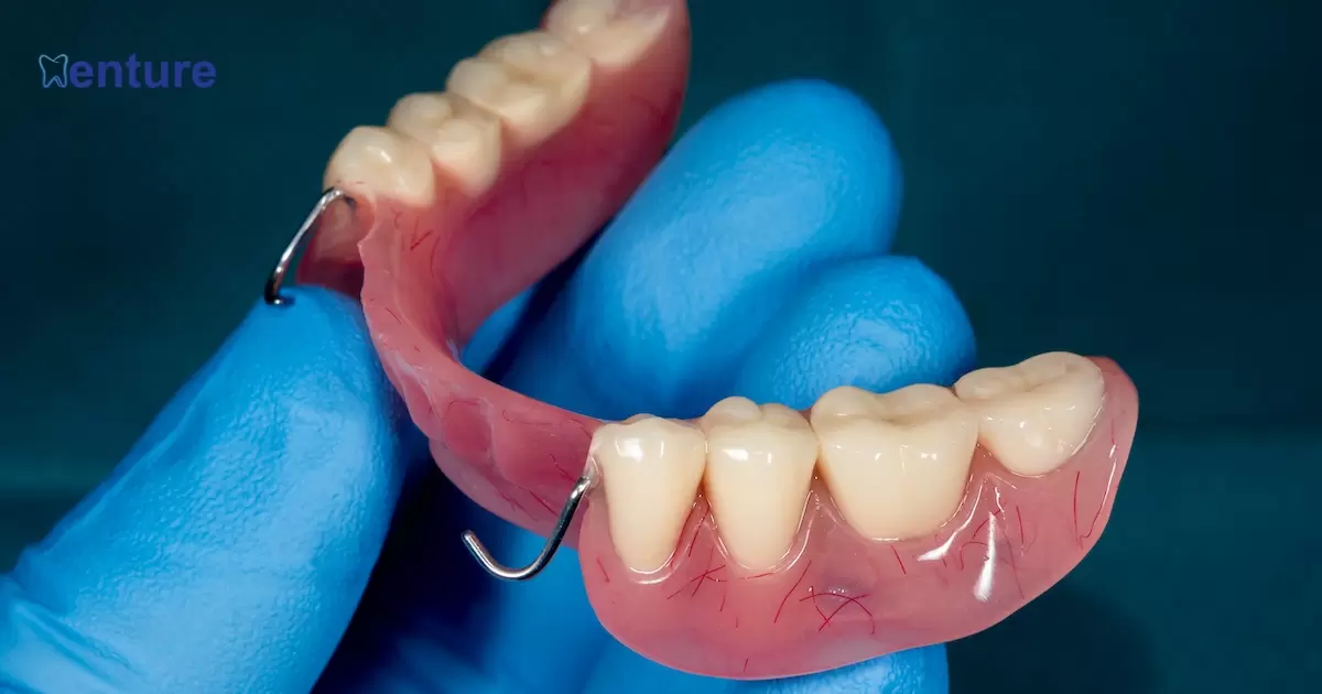 What Do Partial Dentures Look Like?