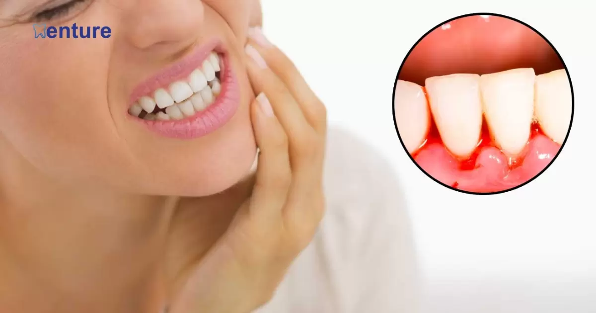 How To Get Rid Of Dry Mouth With Dentures?