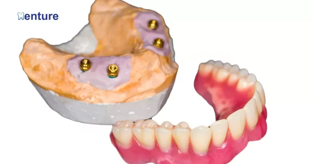 Bone Loss with Dentures