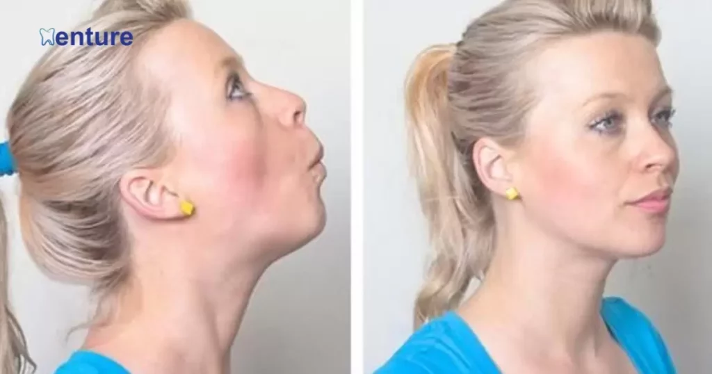 The Benefits of Jaw Exercises