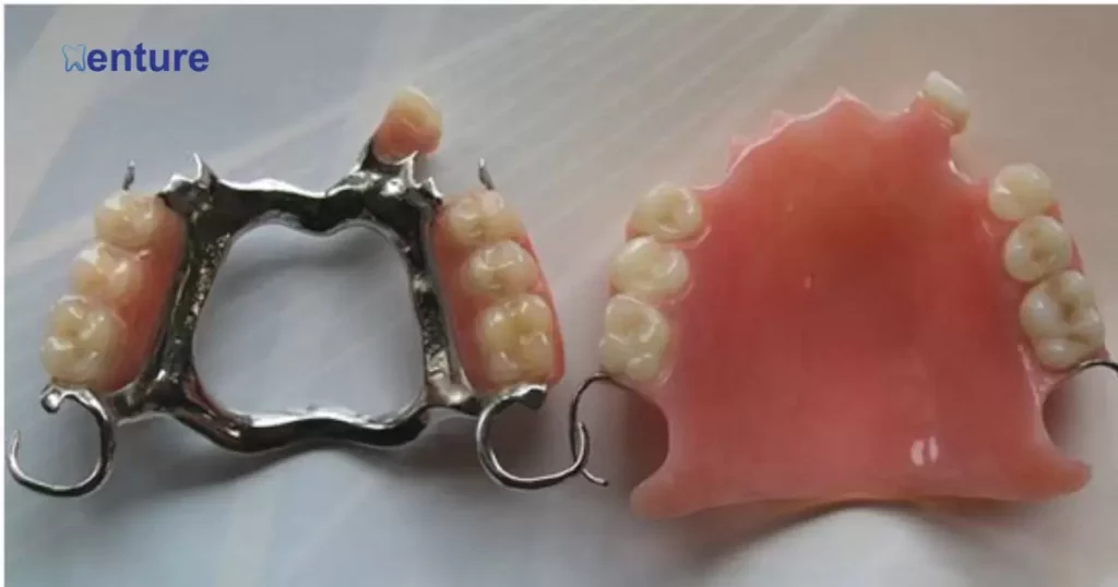 5 Solutions For Metal Clasp Problems On Partial Dentures