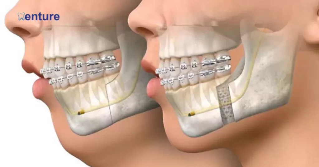 Limited Mobility Of The Jaw Or Lips