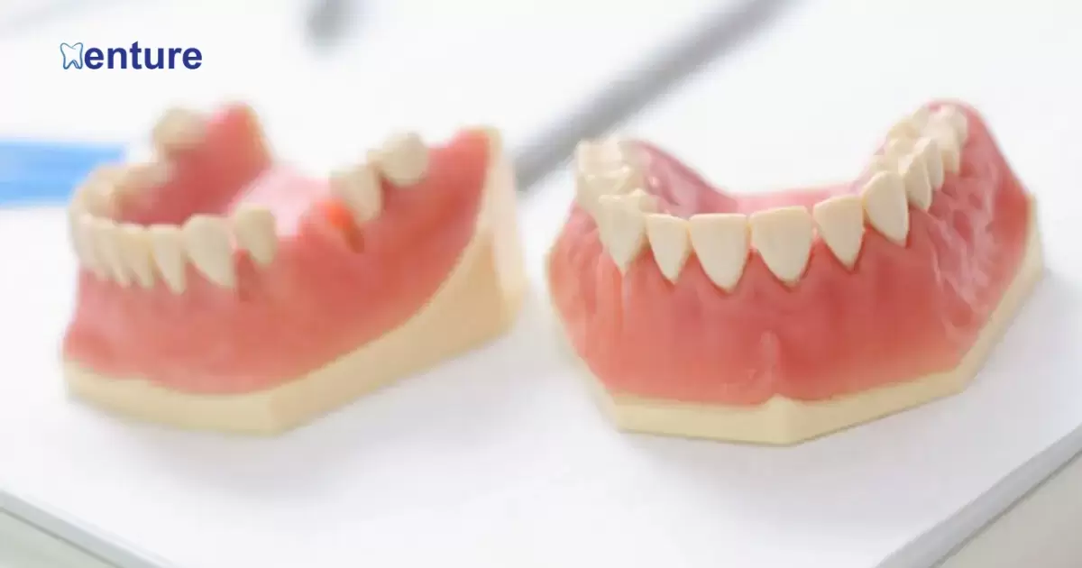 What Are Ultimate Fit Dentures?