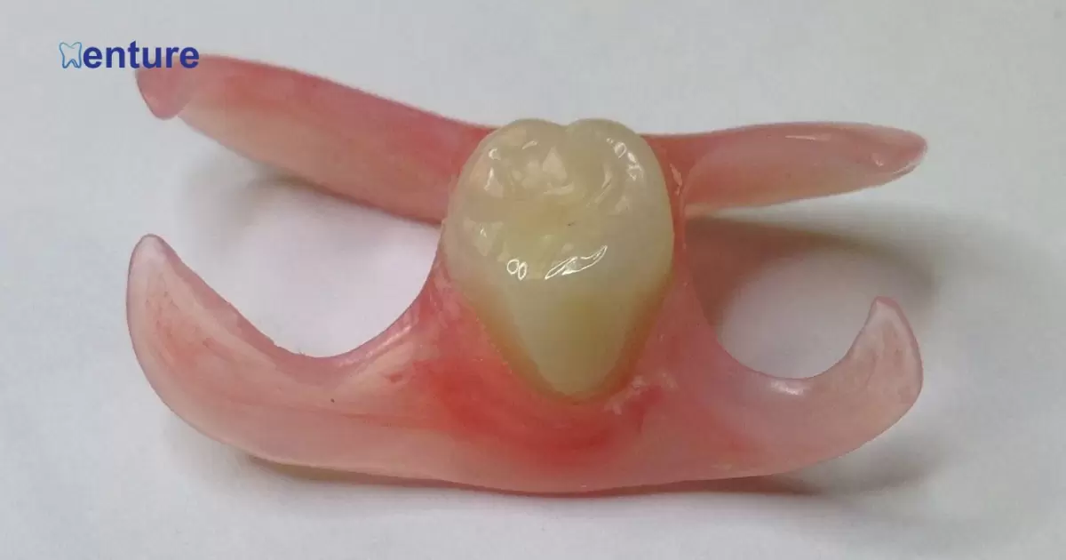 What Does A Single Tooth Denture Look Like?