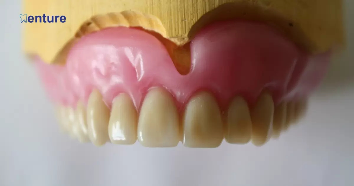 Why Do Some Dentures Look Like Horse Teeth?