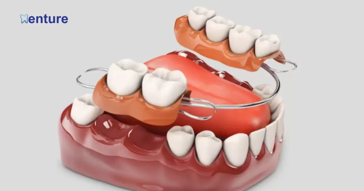 Are Partial Dentures Worth It?