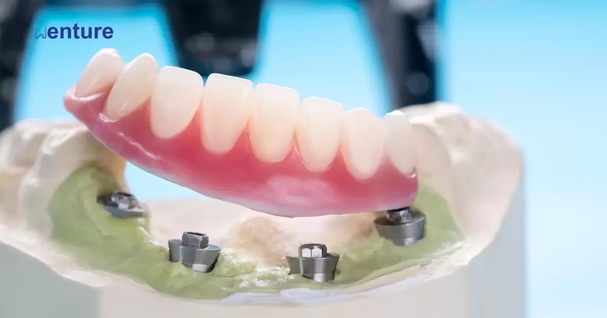 Are Anchored Dentures The Same As Implants?