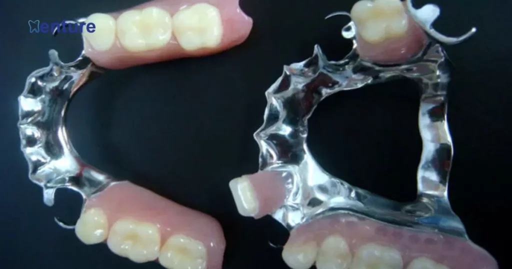 Are Partial Dentures Worth It?