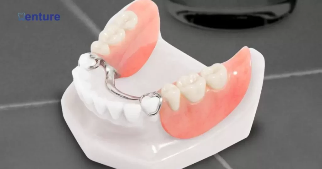 The Need to Add a Tooth to a Denture