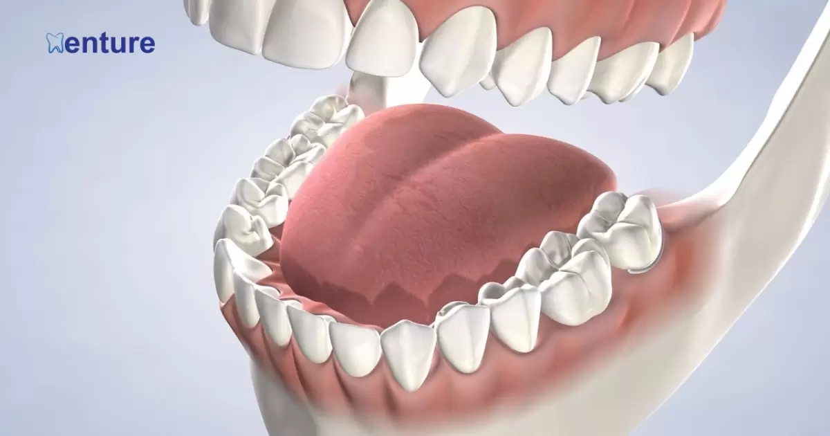 Can I Get Dentures With Bone Loss?