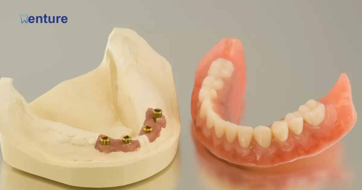 Can Snap In Dentures Be Made Permanent?
