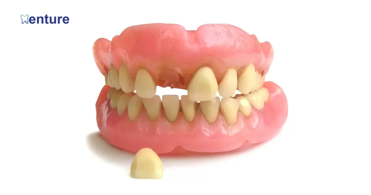 Can You Add A Tooth To A Denture?