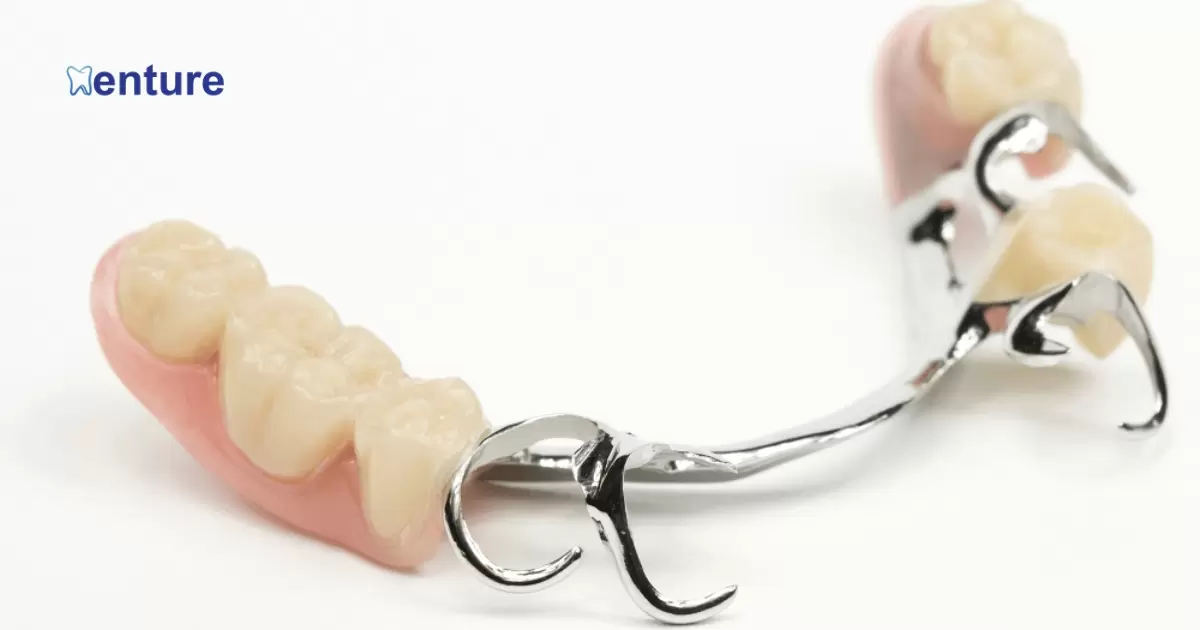 Can You Add Teeth To A Metal Partial Denture?