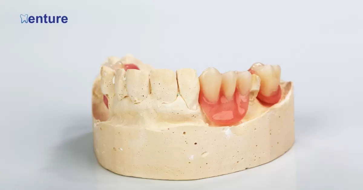 Can You Get A Partial Denture For One Tooth?