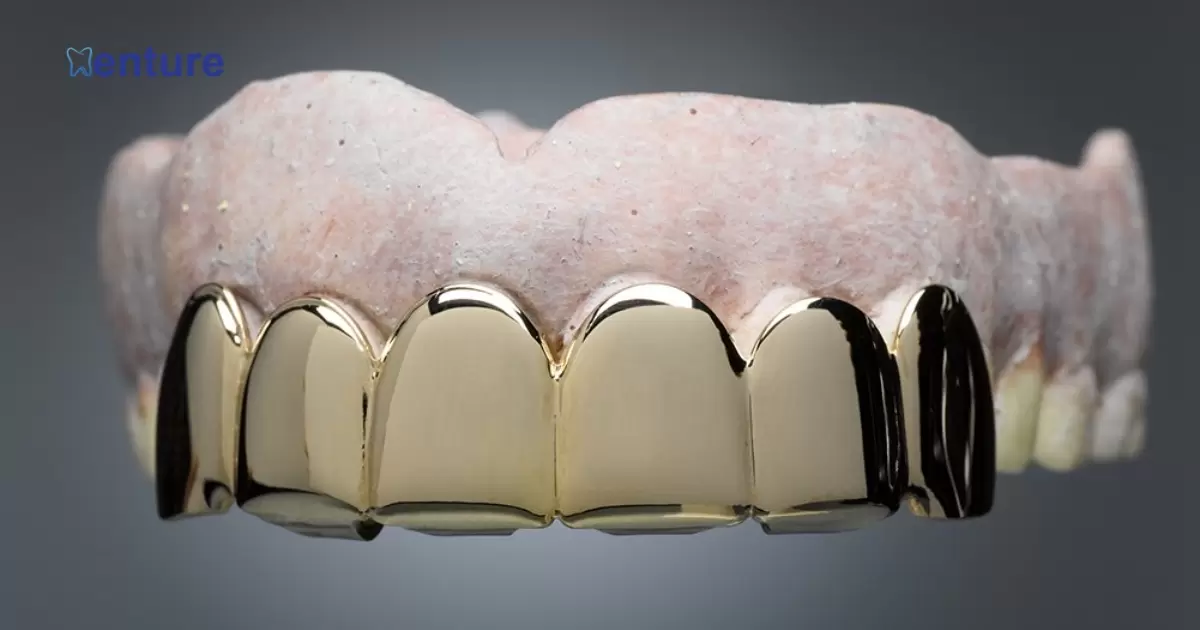 Can You Get Gold Teeth On Dentures?
