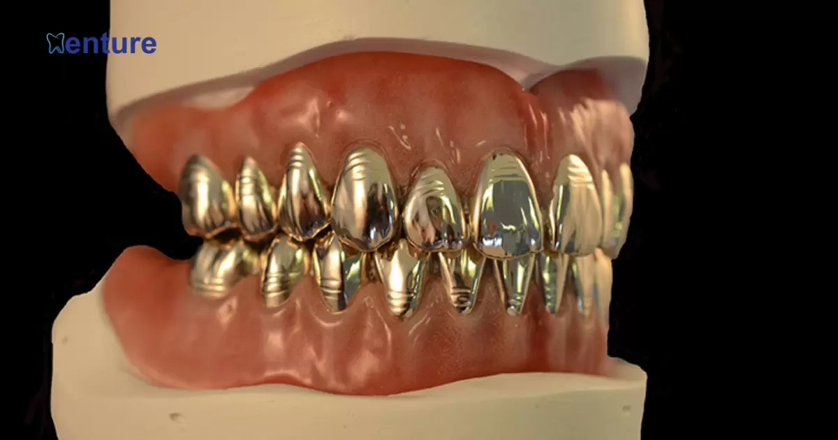 Can You Put A Grill On Dentures?