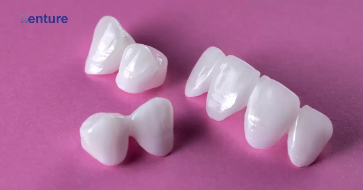 Can You Put Veneers Over Dentures?