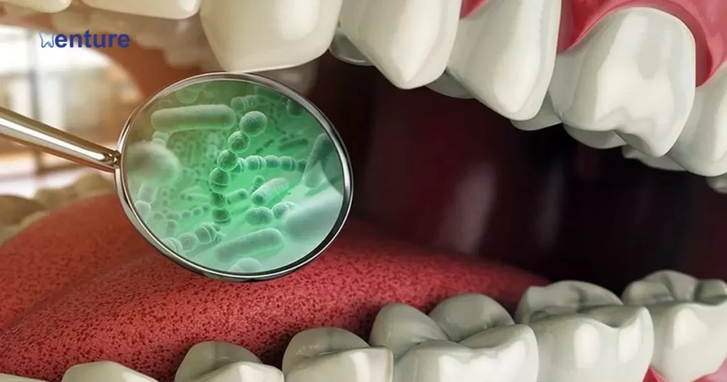 Cleaning Dentures After Strep Infection