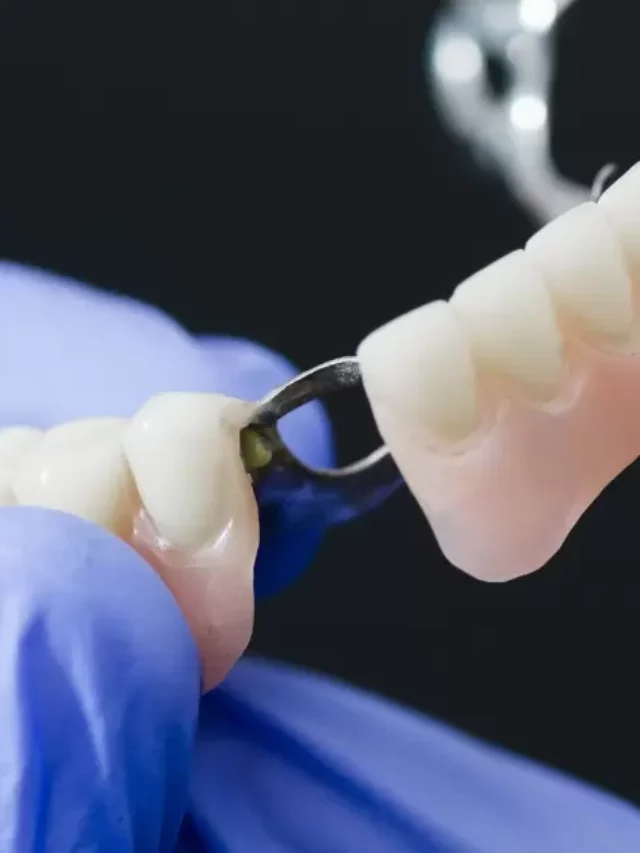 How Is A Partial Denture Made?