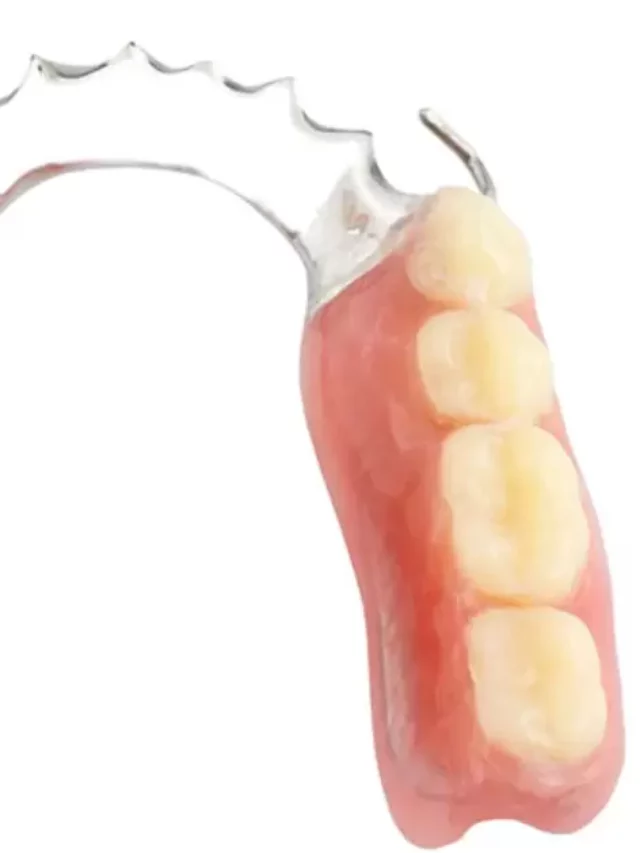 How Long Does A Partial Denture Take To Make?