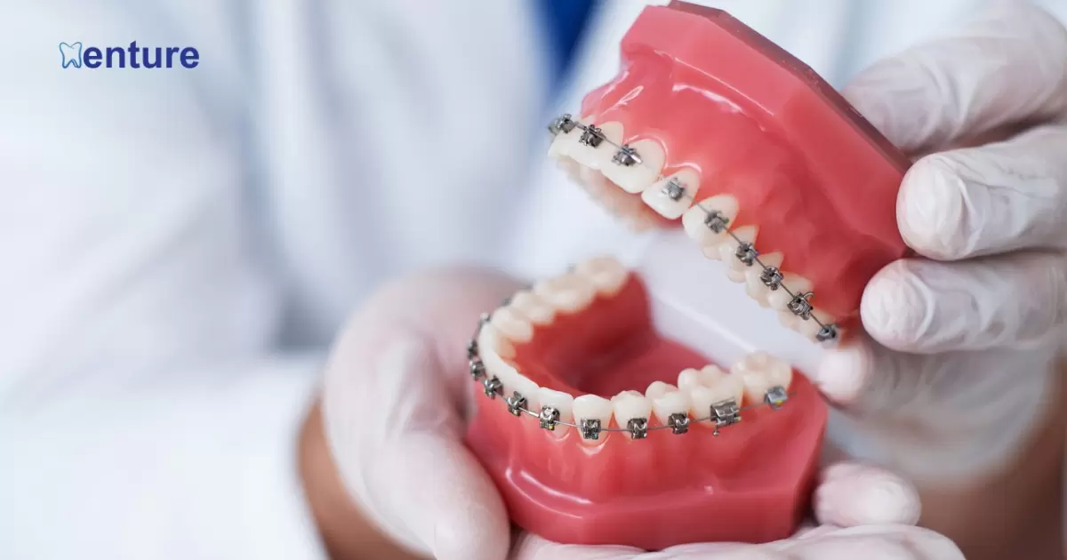 Do Dentures Have A Warranty?