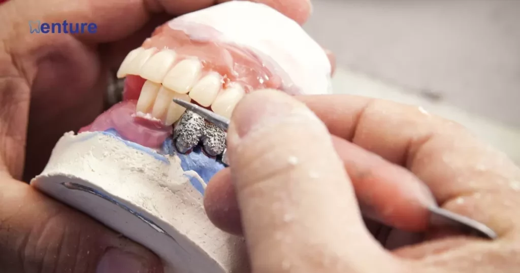 First Denture Reline