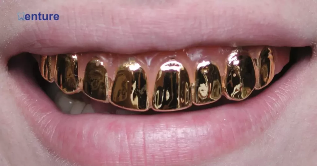Gold On Dentures