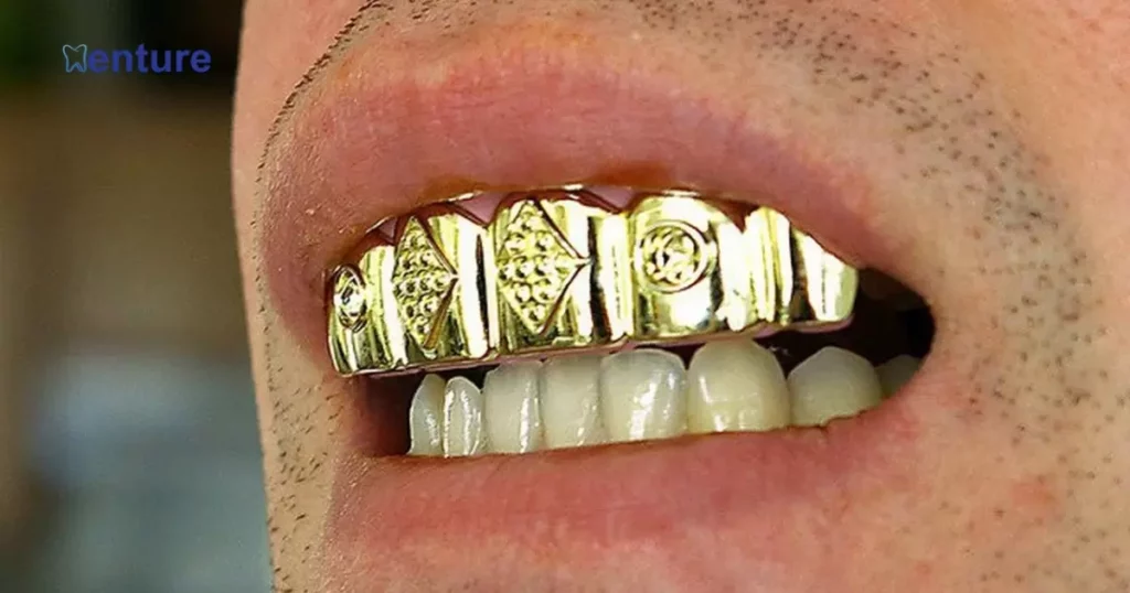 How Do Grillz Stay On Your Teeth?