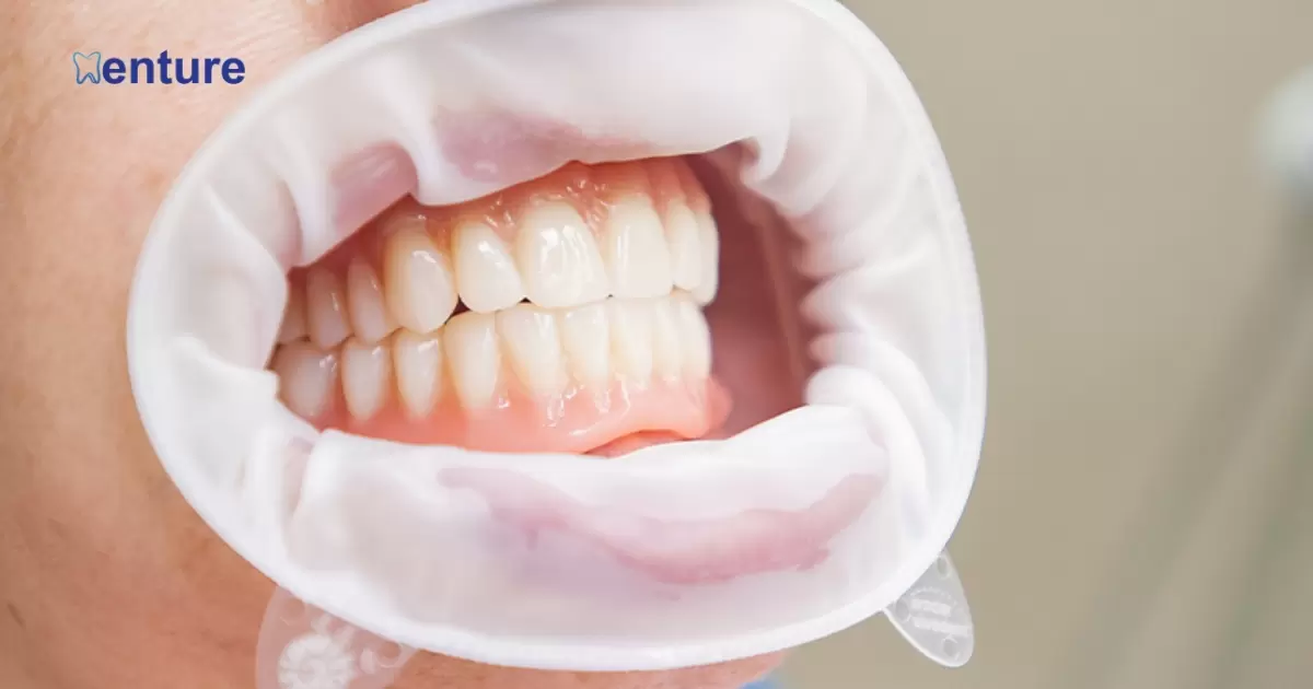 How Often Should Dentures Be Relined?