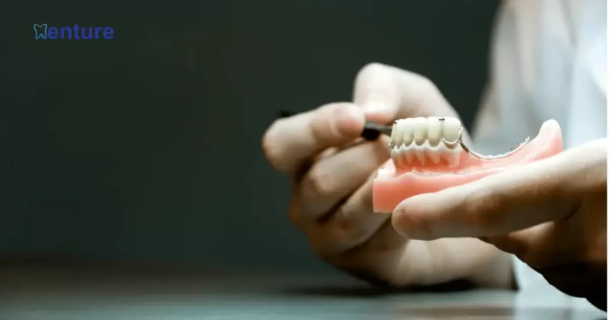 How Soon Can I Use Adhesive On Immediate Dentures?