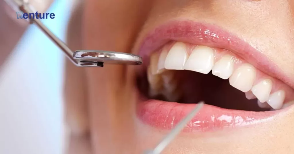 Impact of Dental Hygiene