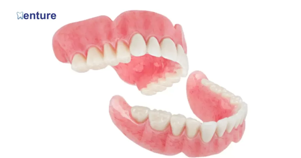 Palateless Upper Dentures Without Implants