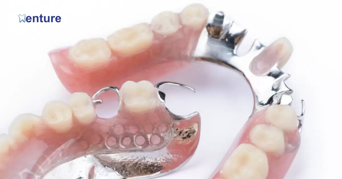 Partial Denture Be Attached To An Implant