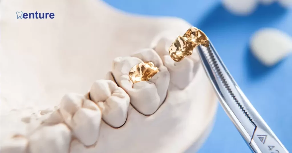 Selecting The Ideal Karat For Gold Dental Work