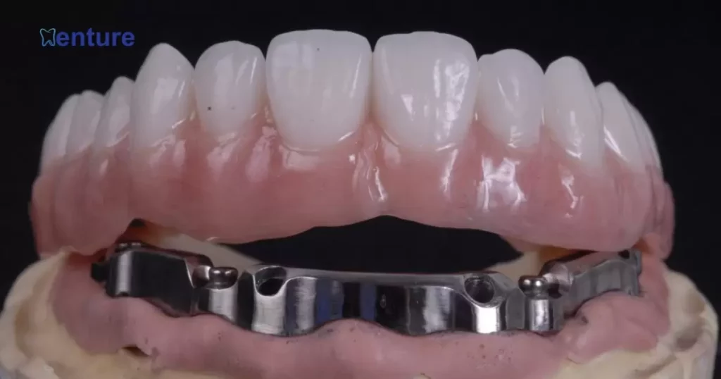 The Mechanics Behind Magnetic Dentures