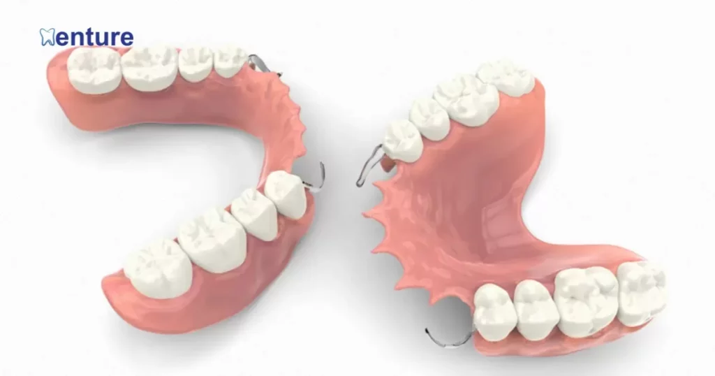 The Process Of Getting Partial Dentures