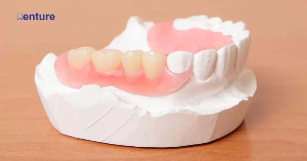 What Are Partial Dentures